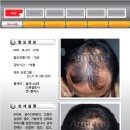 아미치0.3 네이버블로그