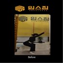목디스크 통증 동탄 수술 후 재활운동 찐 후기