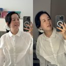 청담동 | 티타늄 리프팅 통증 효과 가격 유지기간, 청담동 피부과 후기