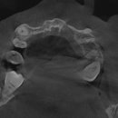 가야치과병원 이미지