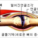 조상일정형외과의원 네이버블로그