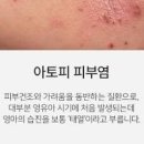 몸에 벌레 기어다니는 느낌 계속 드는 이유 필요한 조치 이미지