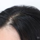 두피온 | 두피모낭염 고민? 올리브영 트리트먼트 오프온 두피 각질, 두피관리 후기