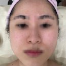 일라에스테틱 | 일라에스테틱 │ 강남피부관리 선릉스킨플래닝 만족 후기