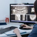 연세우일치과병원 | [아산 연세원치과]사랑니 대학병원 꼭 가야 할까?