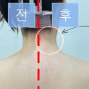 뷰티다옴 | 천안웨딩 예신관리 어디서? 두정동 뷰티다옴 뒷목왁싱·등왁싱·스킨플레닝 시술 후기