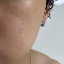🌿 모공팩 추천! [스킨푸드] 레드빈 트라넥사믹애씨드 푸드마스크팩 말끔모공 후기