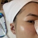 투투헤어라인 이미지