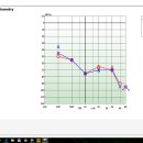 보청기 무료컨설팅 기록 2 (70대 여성회원분의 보청기 상담 기록 ( 1차 컨설팅 내용만 우선 올립니다. )) 이미지