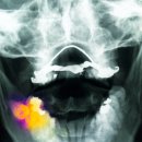 김플란트치과의원 이미지