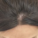 헤어팡팡 | 여자두피문신 고민, 사진 찍을 때 유독가르마가 하얗게 비어보인다면? [잠실 헤어팡팡 시술후기]