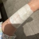 디스테이션(D,S) | [ 일산차 선택제왕 출산후기 2 ] 제왕절개 D-DAY 수술 당일 리얼 기록 (통증, 저혈당, 첫 울음까지)