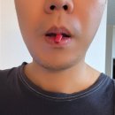 시원메딕스 | 네오메딕스 덴티포뮬러 🦷 잇몸부었을때 사용해야하는 꿀템