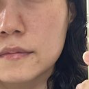 e편한세상초지역센트럴포레아파트 105동, 106동 앞 | 안산 원곡동 피부관리 솔직 후기/스무살에머물다 안산 원곡점