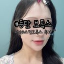 야니소프트 | 효과 확실한 이마보톡스 | 동탄 보톡스