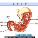 의학 상식 - 위염증상 및 식이요법 이미지