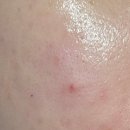 오일스팟 이미지