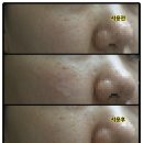 사과나무 토탈케어 | [사과나무맘스홀릭카페/GE-7 멀티이팩트 스킨에센스] 스킨과 에센스가 하나로!