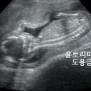 윤톨