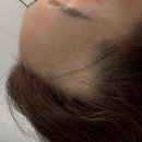 수정헤어라인 - 김해시 인제로169번길 10 | 울산 삼산동 헤어라인문신 자연스럽게 완성! 마노뷰티 퀵앤핏헤어라인 솔직 후기