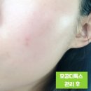 올가드림뷰티오산원동점 | 오산 피부관리샵 올가뷰티 세교점 모공디톡스 후기