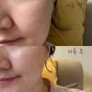 리프팅케어 추천, 시세이도 바이탈 퍼펙션 크림 &amp; 마스크팩으로 안티에이징 홈케어리프팅하기