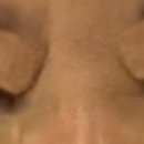 반듯한 멍이 이미지