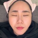 메인메디칼 | 광주 첨단피부관리샵 광메디칼 하이푸리프팅 후기