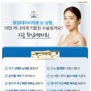 강남쌍수, 청담비아이의원을 선택해야 하는 이유(쌍꺼풀 수술 후기)
