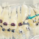 가지런이치과교정과치과의원 이미지