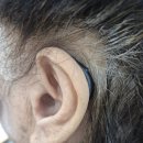 군산유니트론보청기 이미지