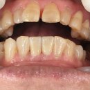 지안치과기공소 이미지