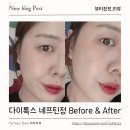 다이톡스 네프틴정 먹고 가짜배고픔 줄어든 후기, 입 심심함 달라졌어요