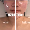 센텀 | 해운대 에스테틱 윤곽관리 추천 끌리메 센텀점 솔직후기