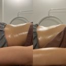 청주복부관리 추천｜금천동 힐에스테틱 솔직후기(복부부종 아랫배 고민 케어)