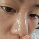고함량 레티날 닥터디퍼런트 효과와 부작용