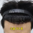 모엠의원 네이버블로그