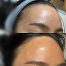 설이헤어라인 이미지