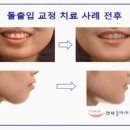 변치과의원 네이버블로그