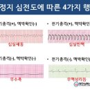 심낭골 | KALS provider 취득 일기 (pretest, 필기, 실기 시험 팁)