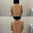 (주)제니스메디칼 | 대구웨딩관리 잘하는 감삼동 플로우테라피에서 상체 슬리밍관리