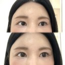 살루스플러스데이케어 | 렌시스 베티베이지 플러스 1개월용 내돈내산 후기[데이케어를 곁들인..]
