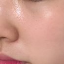 하이포레버 네이버블로그