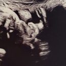 마상로102번길 | 일산 산후도우미 업체 계약하기 (비추, 추천 후기 추가)