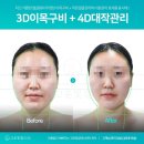 아름다운자연주의화장품 | 대구피부관리 고운빛깔에스테틱대구점 신부관리가 만족스러웠던 동성로 윤곽 케어 후기