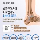 발목인대파열수술 4세대 봉합술로 회복기간 단축하세요 이미지