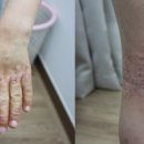 대구프리허그한의원 이미지