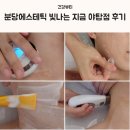 빛나는 | 분당에스테틱 빛나는 지금 야탑점 후기