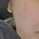 강남의료기 | 강남 르모아의원 내돈내산 ' 벨로테로리브이브 ' 솔직후기!!!