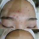 영 피부관리실